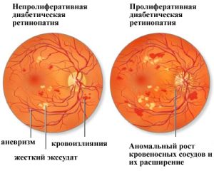 рис 4