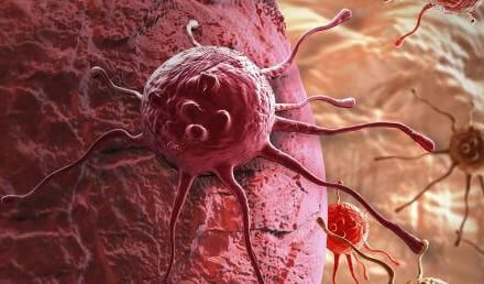 Recupero dal cancro